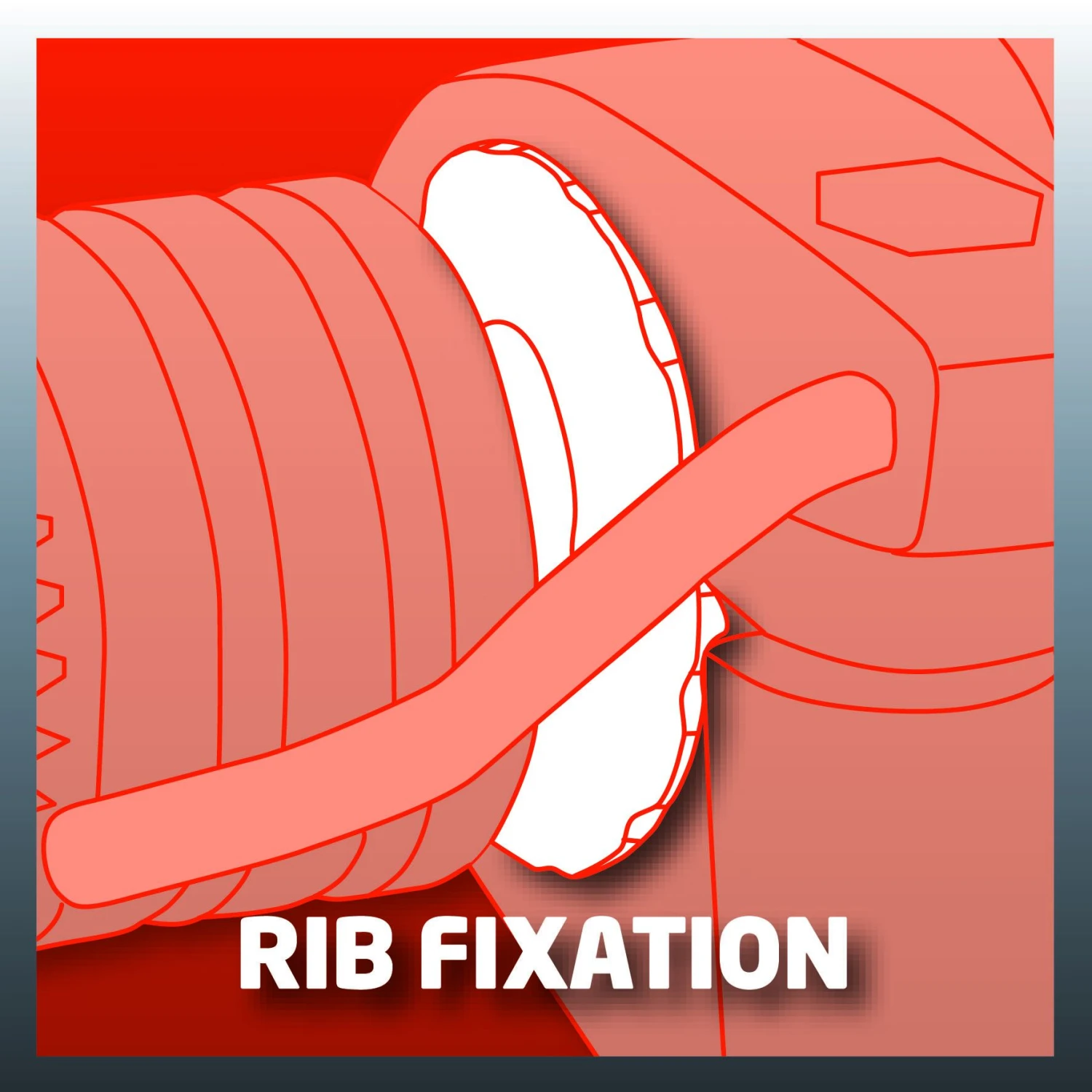 Einhell TC-ID 1000 E Klopboormachine - 1010W - 32mm 11 Einhell TC-ID 1000 E Klopboormachine - 1010W - 32mm - Afbeelding 9